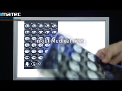 Film per l'imaging medico a getto d'inchiostro per l'ultra-suono di risonanza magnetica a raggi X