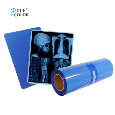 IMATEC Blue PET Inkjet Medical CR Film per radiografia a raggi X Per stampanti Canon