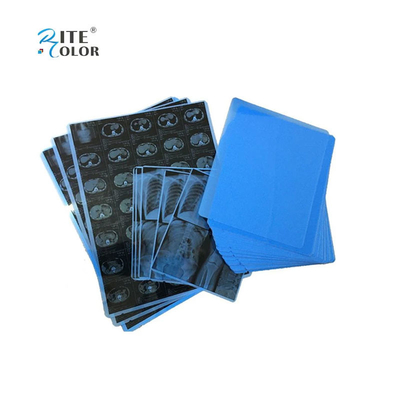 Stampa a getto d'inchiostro con pellicola medica PET blu per raggi X in fogli A4 8x10 14x17