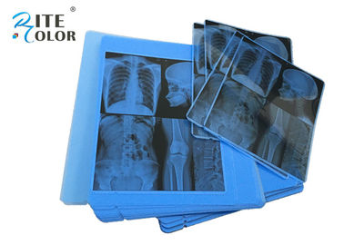 Spessore blu del film 210um di imaging biomedico di X Ray di radiologia per la stampante a getto di inchiostro di Epson