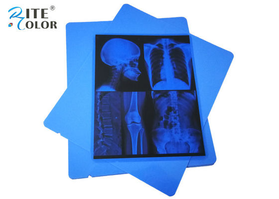 Low Fog A4 Blu PET Pigmento secco Inkjet 210 Micron Film Medicale a raggi X Eco Friendly