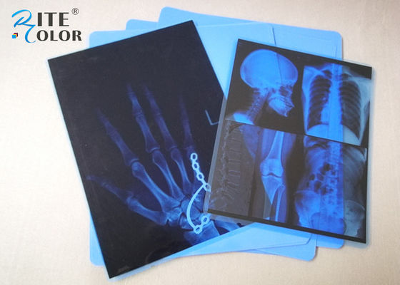 Film blu 8 x di imaging biomedico del getto di inchiostro dell'ANIMALE DOMESTICO della nebbia bassa a 10 pollici per la stampante di Epson