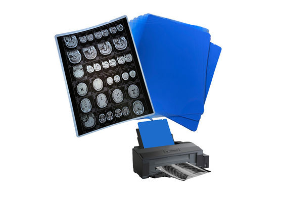 210um 8x10 A3 A4 Blu Film a getto d'inchiostro medico per radiologia